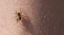 Spider bite - characteristic symptoms