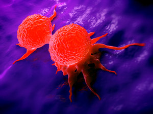 Discover "Transformation" Metastases - a breakthrough in the fight against cancer
