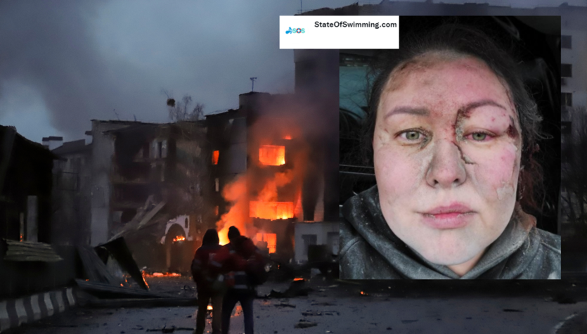 The war in Ukraine.  Agona Morozova was trapped under the rubble.  Shocking confession of a Ukrainian woman