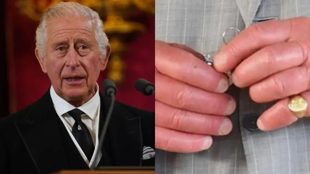 King Charles III's "sausage fingers" cause a reaction