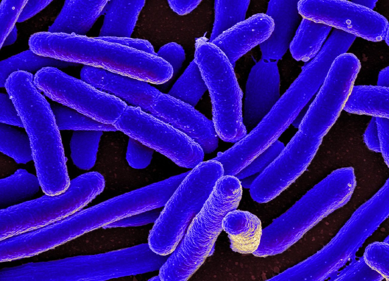 How do bacteria move?  The mystery was solved years ago