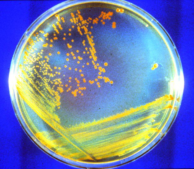 Deinococcus radiodurans bacteria in a petri dish culture/Michael C.  Dali / USU / Press Materials