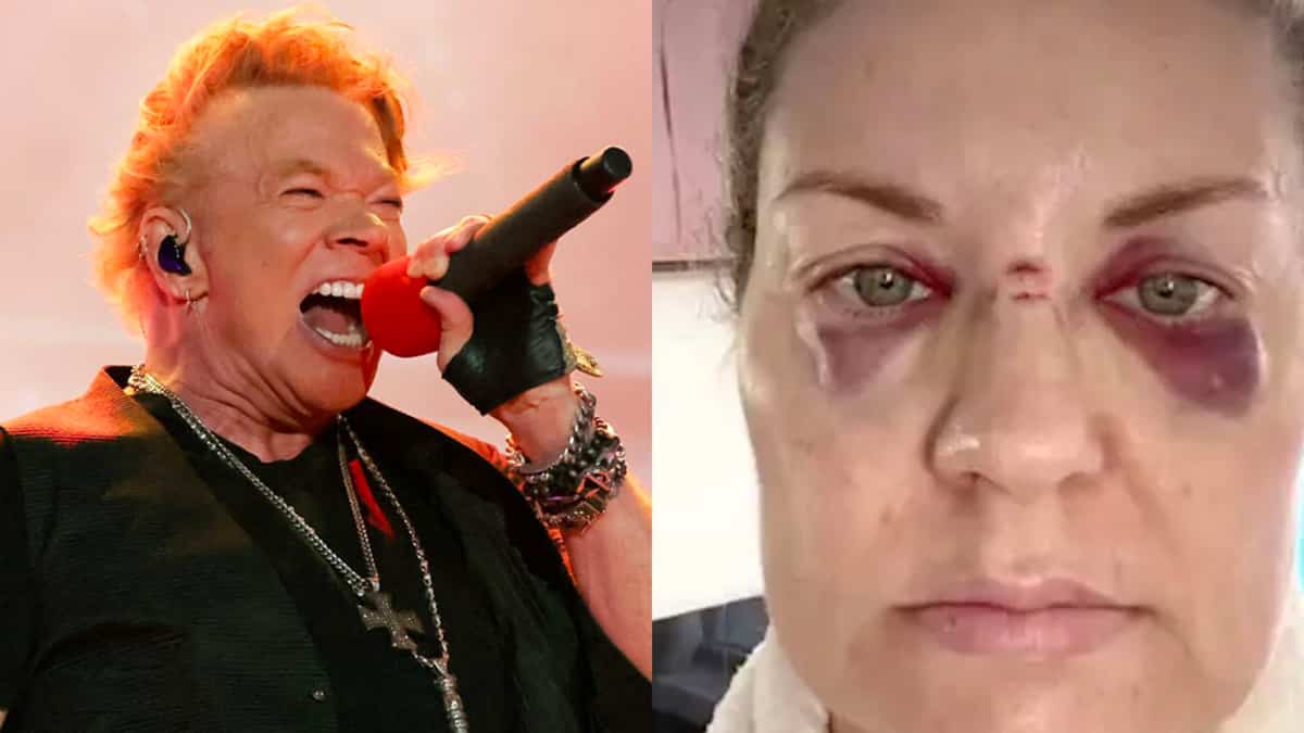 A microphone thrown by Axl Rose hits a woman in the face and leaves traces
